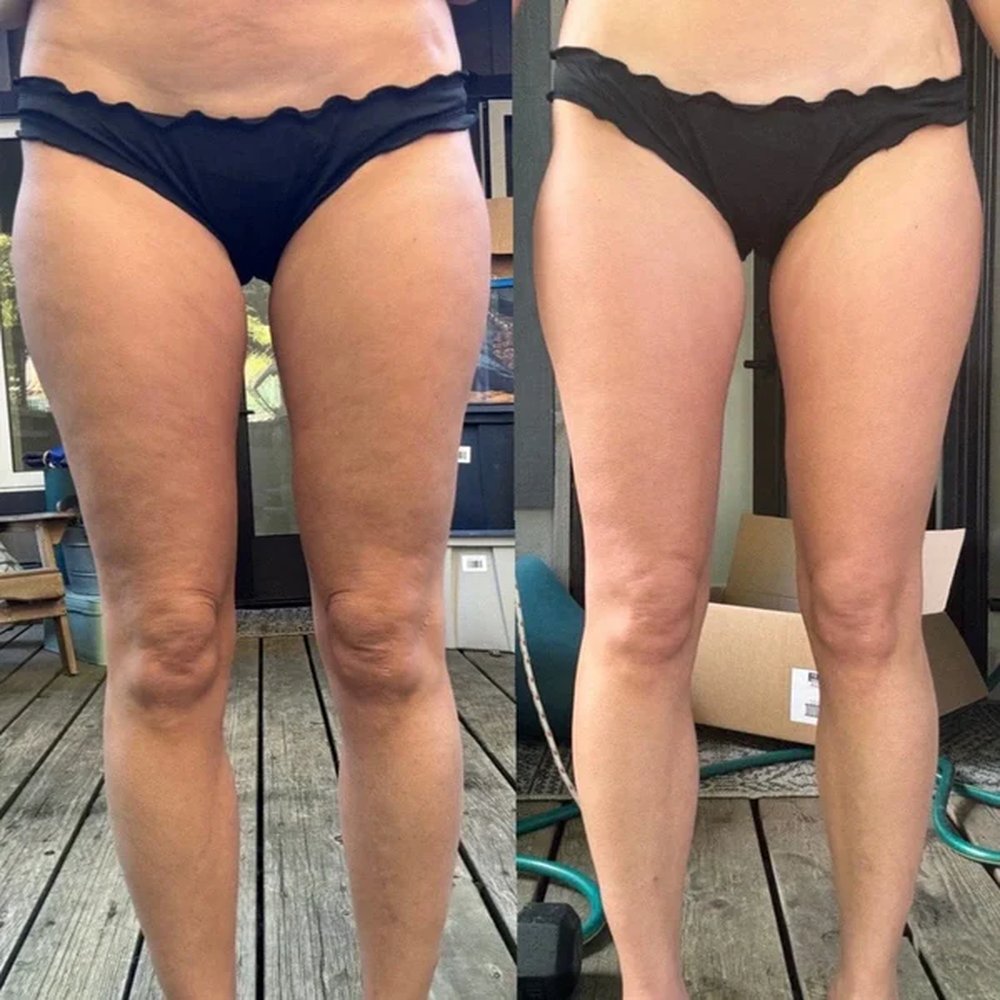 CelluBreak Siéntete más cómoda en tu piel y con confianza renovada cada día + Envío Gratis