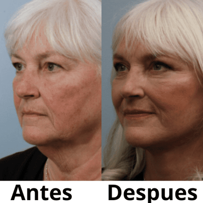 FacialRenew™ Renueva tu piel + Ebook Gratis