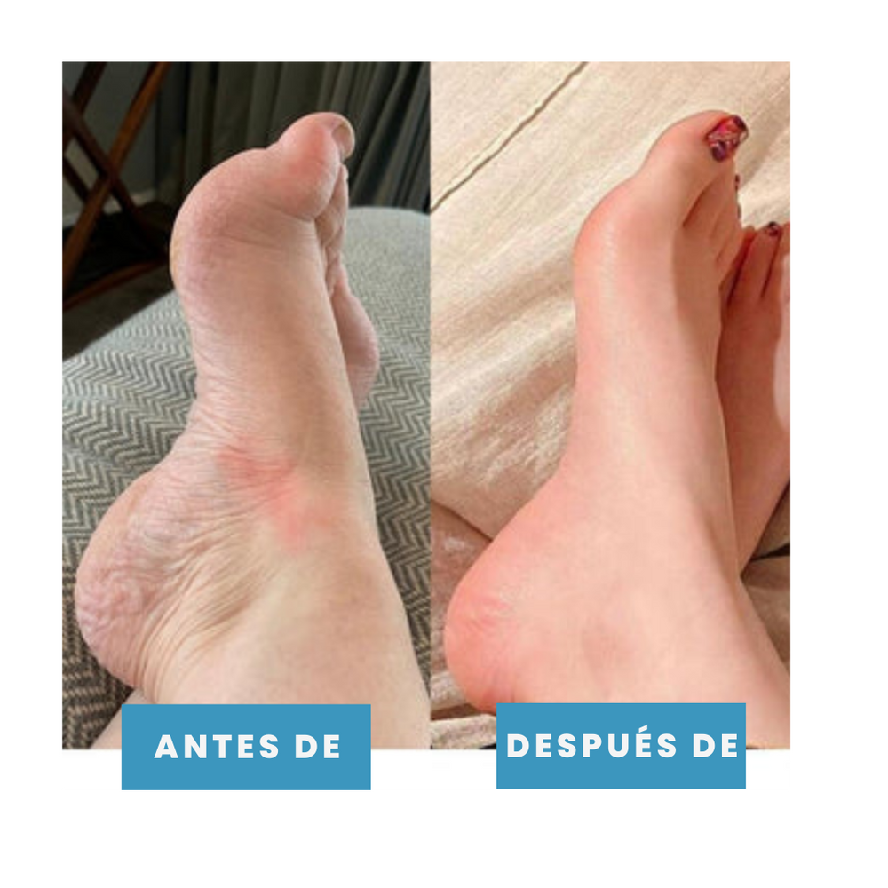TheraPies Alivia el dolor y reduce la hinchazón en minutos + Envío gratis