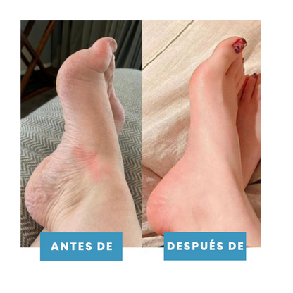 TheraPies Alivia el dolor y reduce la hinchazón en minutos + Envío gratis