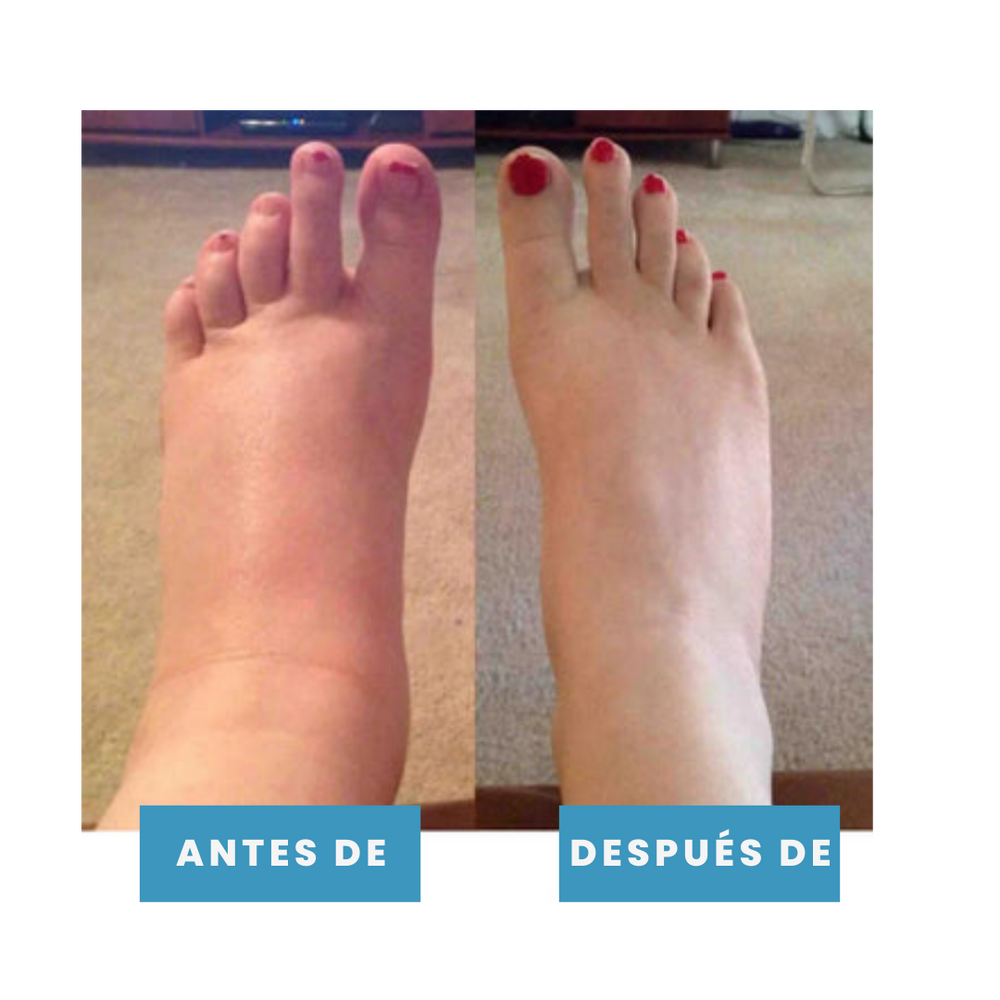 TheraPies Alivia el dolor y reduce la hinchazón en minutos + Envío gratis