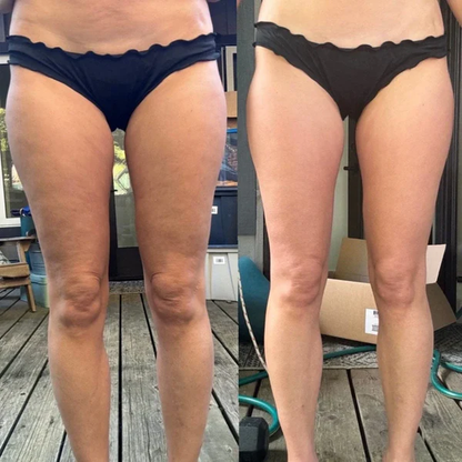 CelluBreak Siéntete más cómoda en tu piel y con confianza renovada cada día + Envío Gratis